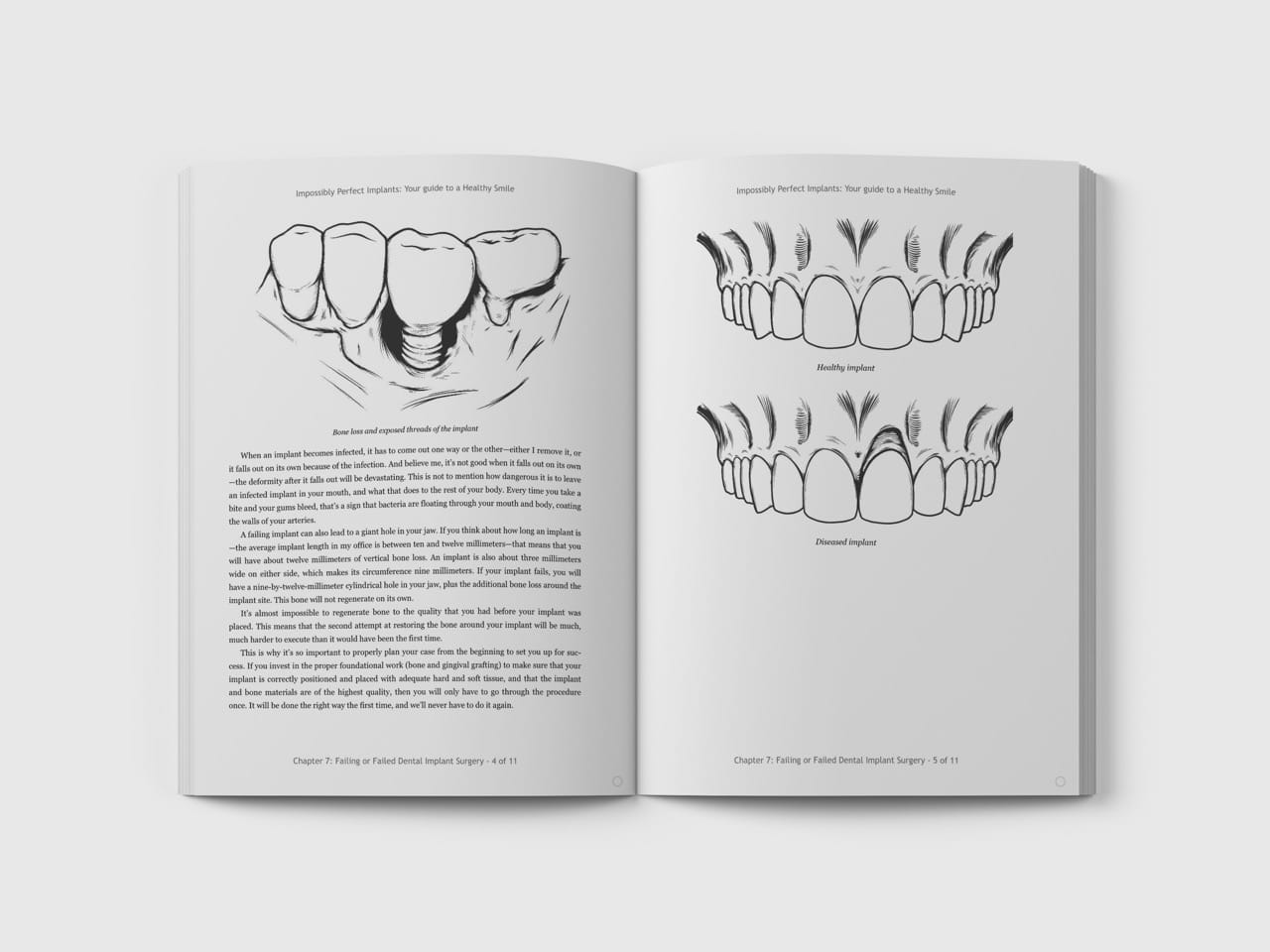 Dental Surgery